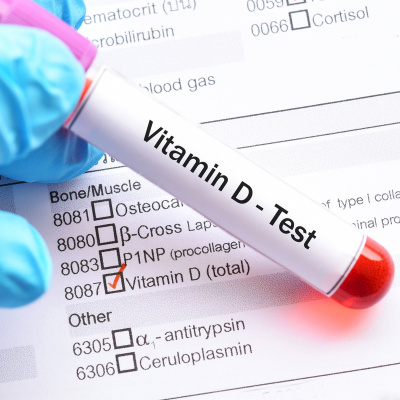 Kraujo tyrimas nebūtinai parodo tikrąjį vitamino D poreikį