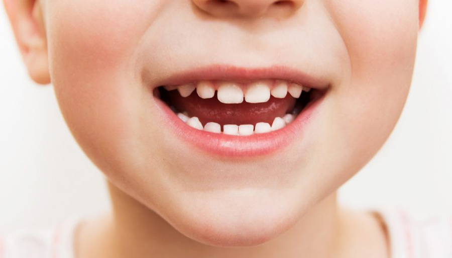 Dantų gydymas miegant – sprendimas vaikams ir suaugusiems, bijantiems odontologų