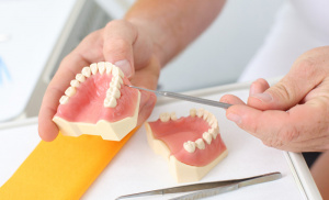 Dantų protezavimo kaina – gana dažnai ieškoma informacija