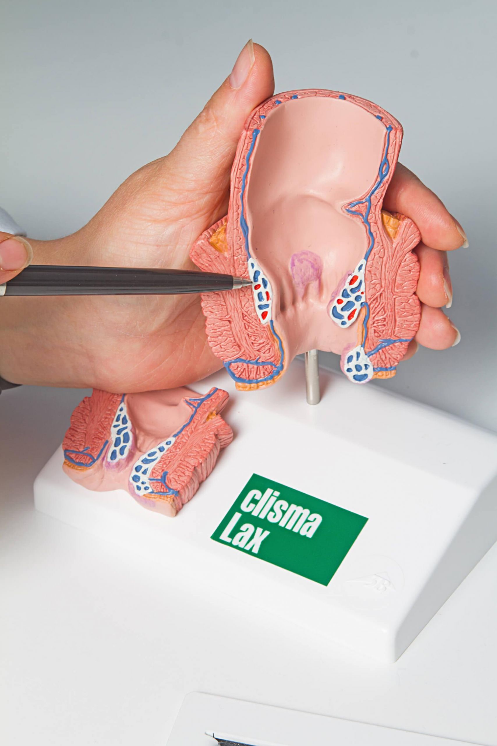 Apyvarpės uždegimas. Kas jį sukelia ir kokį gydymą rinktis? /