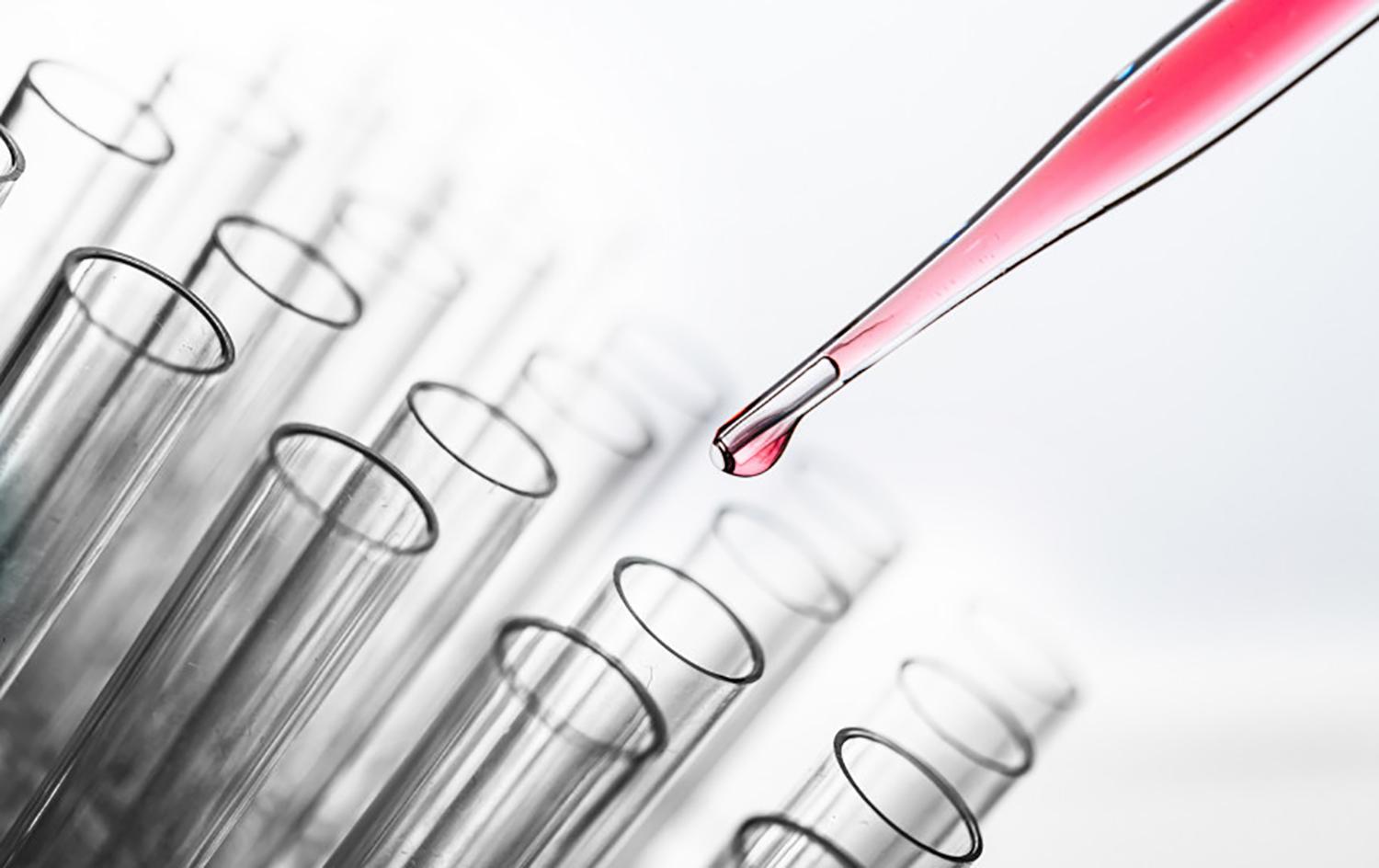 COVID-19 galimai persirgo 1