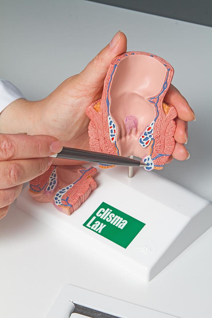 Kaip vyro gyvenimą gali įtakoti lėtinis prostatitas /