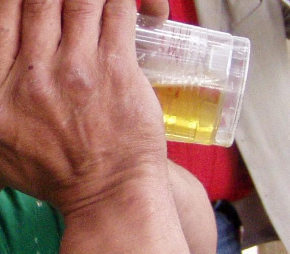 Labai norėjo gerti... /