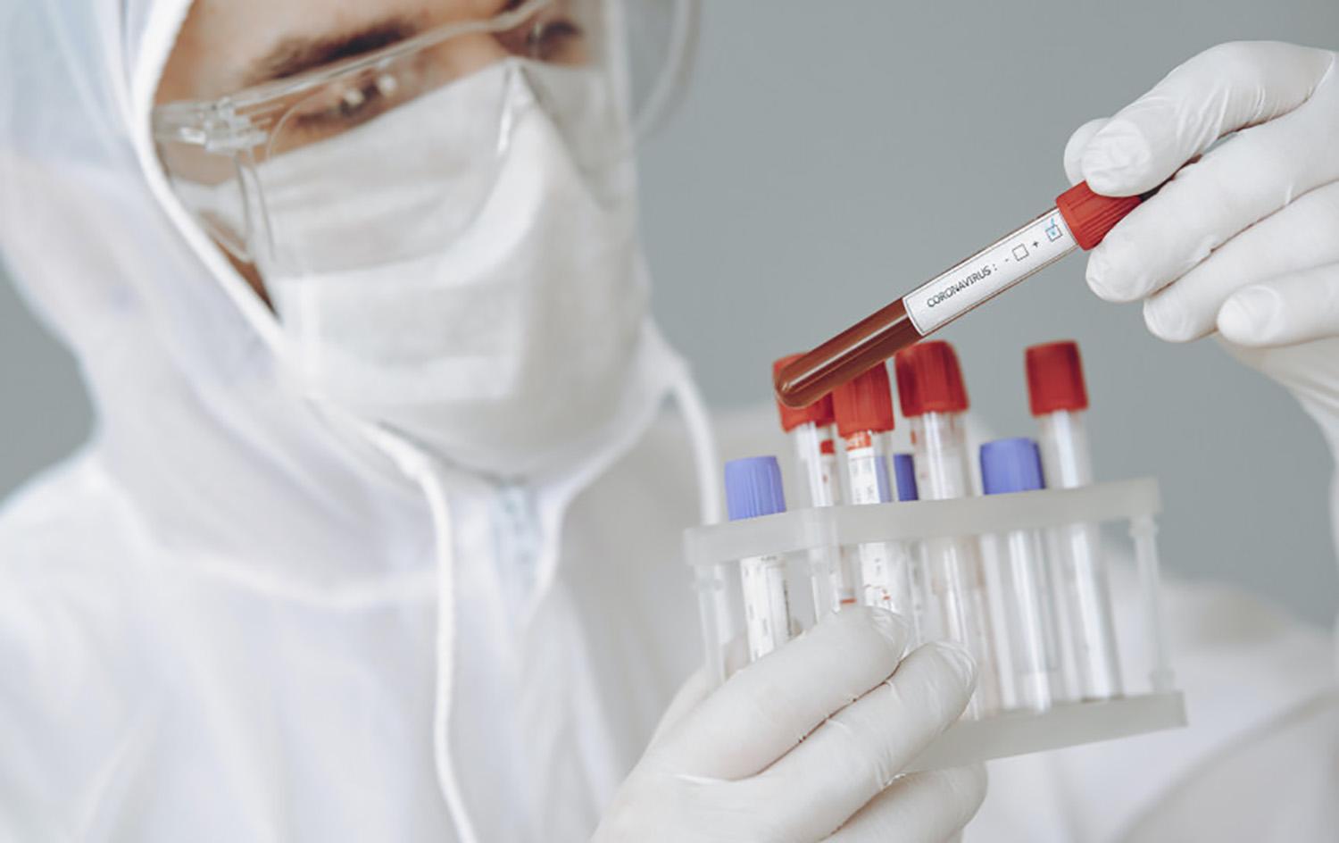 Plečiamos profilaktinio testavimo nuo COVID-19 grupės /