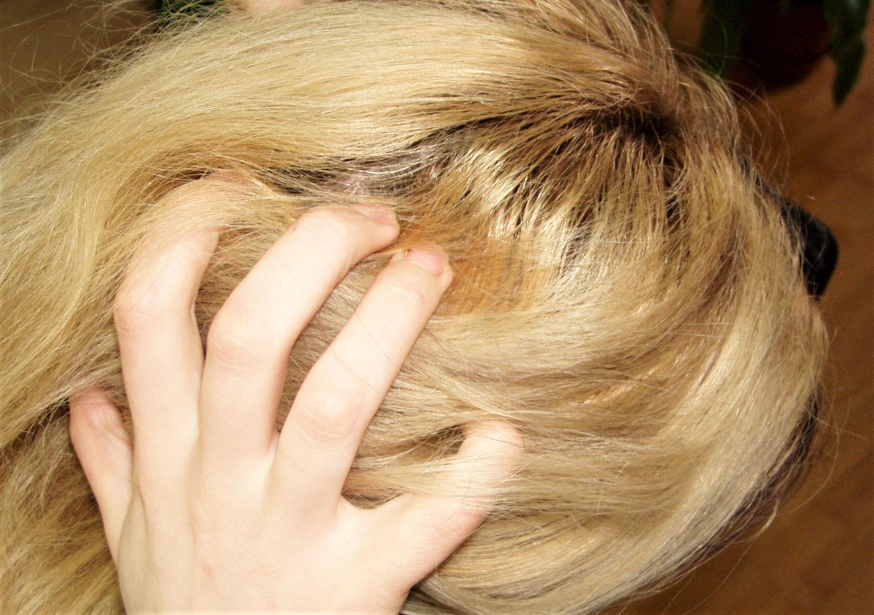 Sutrikusios psichikos žmonių bendrijos vadovas: išmokome priimti tik fizines negalias /