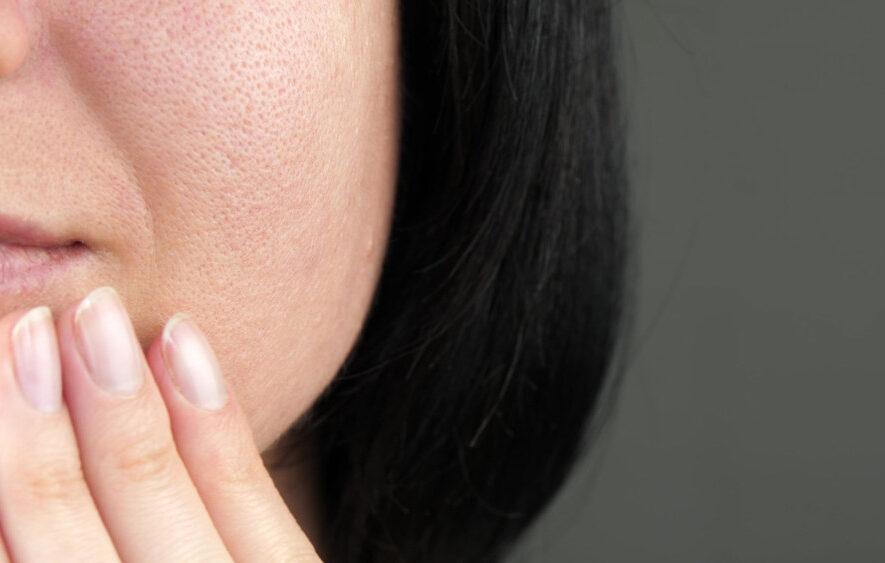 Sveika oda: kaip prižiūrėti ir ko vengti? /