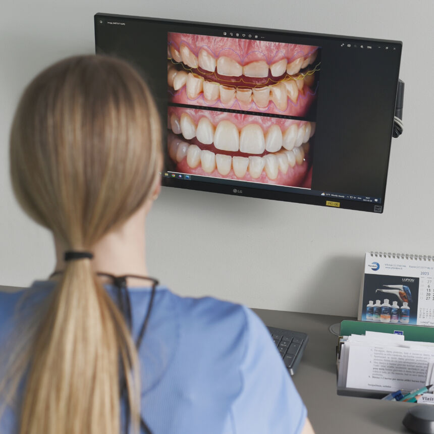 Periodontito gydymas padeda išsaugoti nuosavus dantis